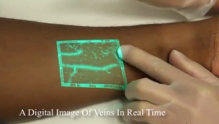 Digital Vein Viewer : The Best Vein finding Technology Gadget